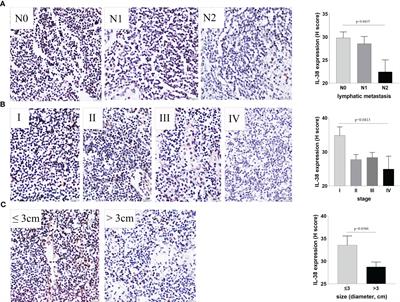 Exploring the clinical significance of IL-38 correlation with PD-1, CTLA-4, and FOXP3 in colorectal cancer draining lymph nodes